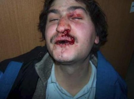 Greqi, policia fsheh dhunen ndaj te rinjve duke trukuar fotot e tyre