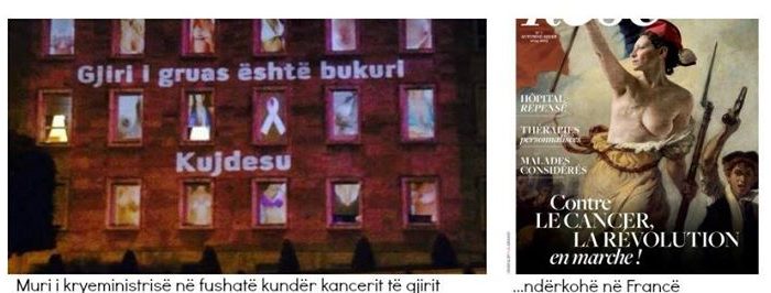 Vdekja te sheh nga gjinjte! Kujdes!