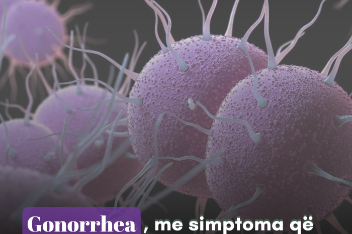 Gonorrhea, me simptoma që mund të mos i vëmë re.